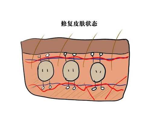 人体皮肤愈合过程（皮肤愈合周期是多久）-图2