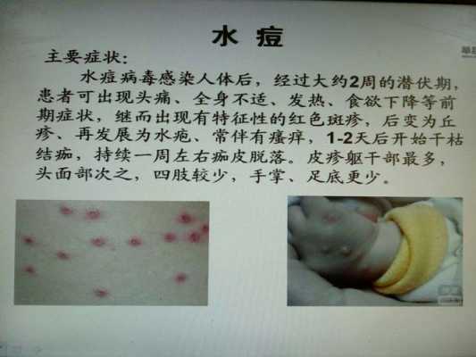 水痘的病变过程（水痘的病变过程图片）-图2