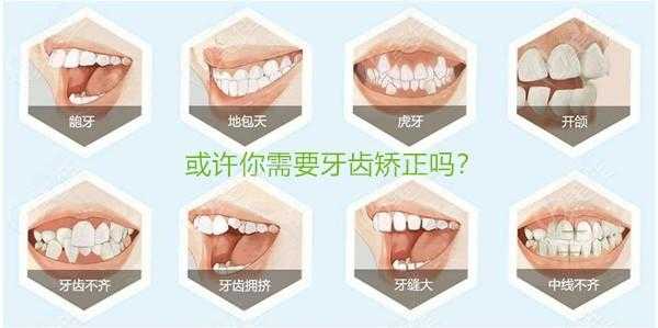 牙齿矫正治疗过程（牙齿矫正过程需要多长时间）-图1