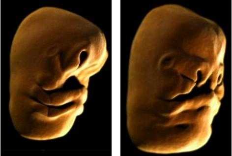 胎儿发育过程中央电视（胎儿发育纪录片）-图1