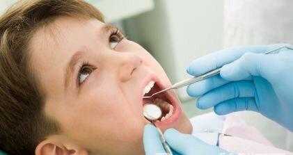 儿童拔牙过程（儿童拔牙技巧图解）-图1
