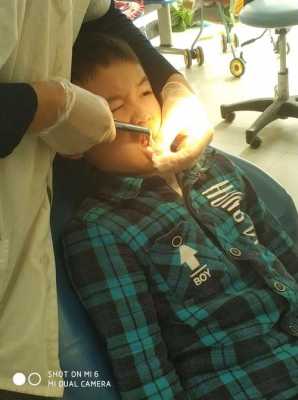 儿童拔牙过程（儿童拔牙技巧图解）-图2