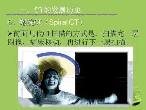 简述CT成像过程（ct成像过程主要包括）-图3