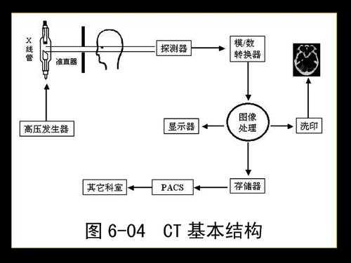 简述CT成像过程（ct成像过程主要包括）-图2