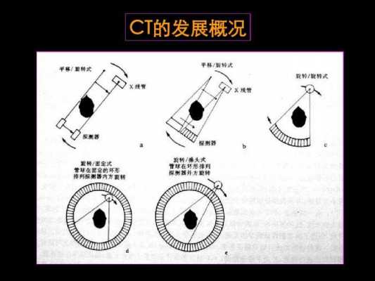 简述CT成像过程（ct成像过程主要包括）-图1