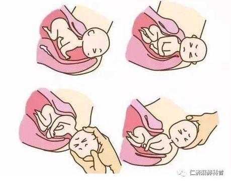 分娩全过程顺序（分娩的全过程分为几期）-图2