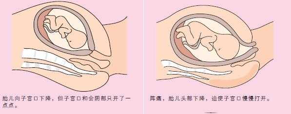 分娩全过程顺序（分娩的全过程分为几期）-图3