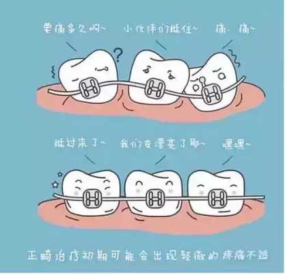 儿童牙齿矫正过程（儿童牙齿矫正过程痛不痛呀多少钱）-图3