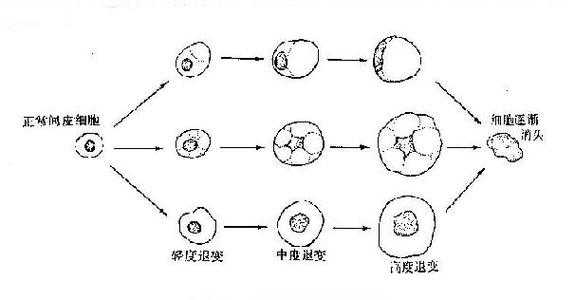 细胞退化过程（细胞退变）-图2