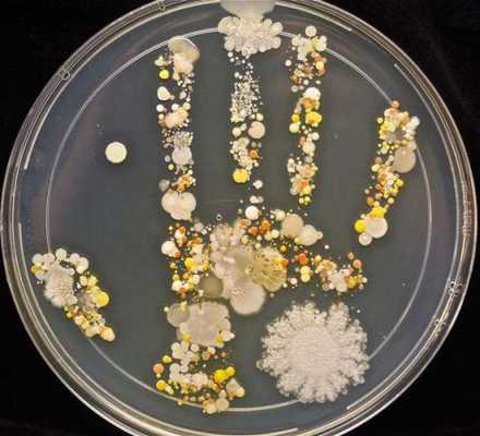 培养手细菌方法过程（如何做手细菌培养）-图2