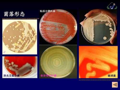 培养手细菌方法过程（如何做手细菌培养）-图3