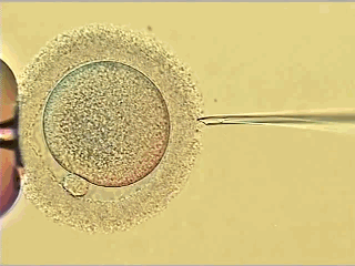 生殖过程GIF（生殖过程中完全摆脱了对水的依赖的植物是）-图1