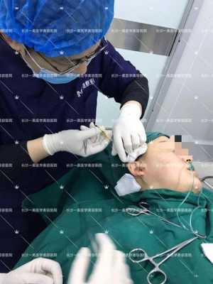 线雕鼻手术过程（线雕鼻手术过程图片）-图3