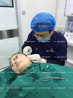 线雕鼻手术过程（线雕鼻手术过程图片）-图2