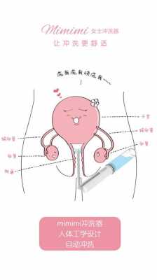 阴道冲洗过程的简单介绍-图2