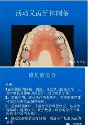 牙齿制备的过程（牙齿的制作流程）-图2