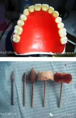 假牙抛光过程（假牙调磨处理）-图1