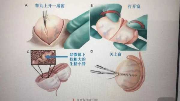 男性取经过程PPT（男士取经子方法）-图1