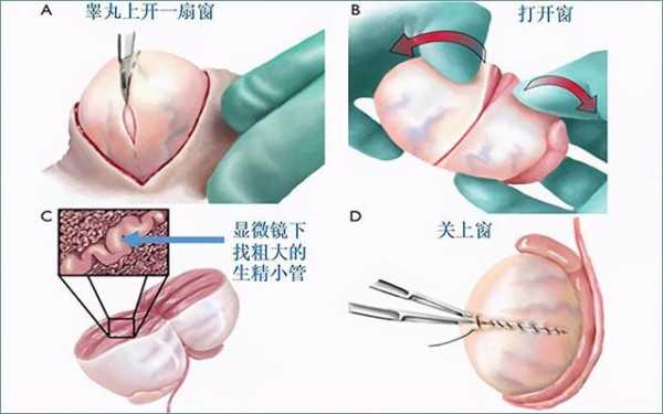 男性取经过程PPT（男士取经子方法）-图2