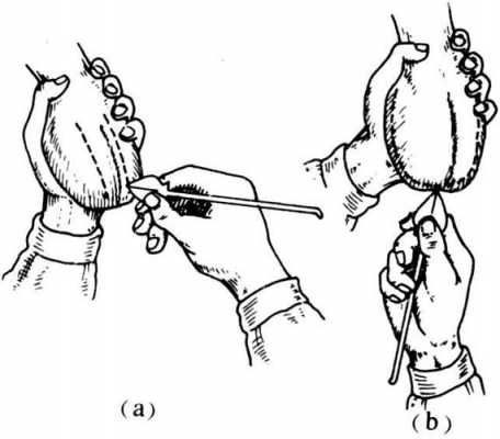 割阉手术过程（割阉疼吗）-图1
