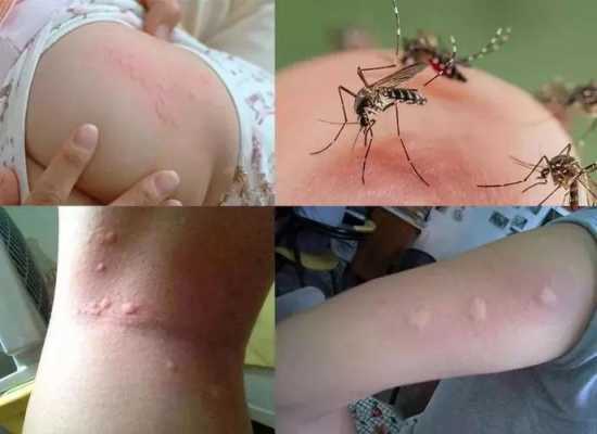 蚊子叮人过程（蚊子叮咬人的过程）-图2