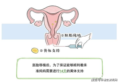 人工移植胚胎过程（胚胎移植人工周期步骤）-图3