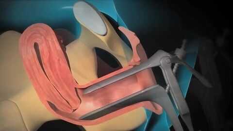 刮宫视频过程（刮宫视频手术过程高清）-图1
