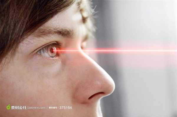 眼睛激光的过程（眼睛激光视频教程）-图1
