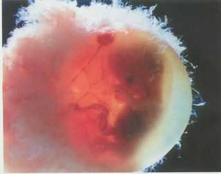 胚胎的过程图片（胚胎的过程图片高清）-图2